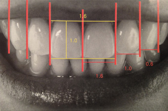 歯並びの理想的な配列